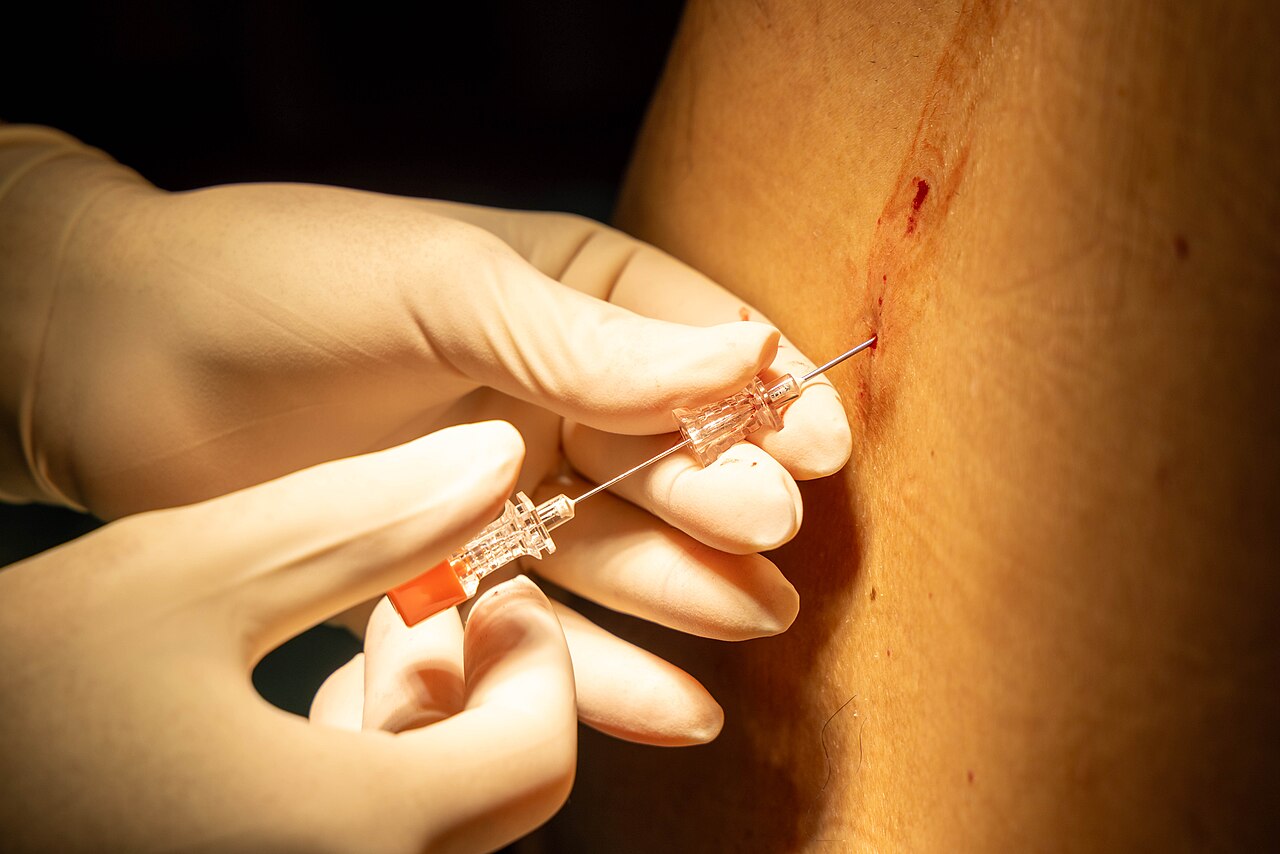 Medical Lesion Generators